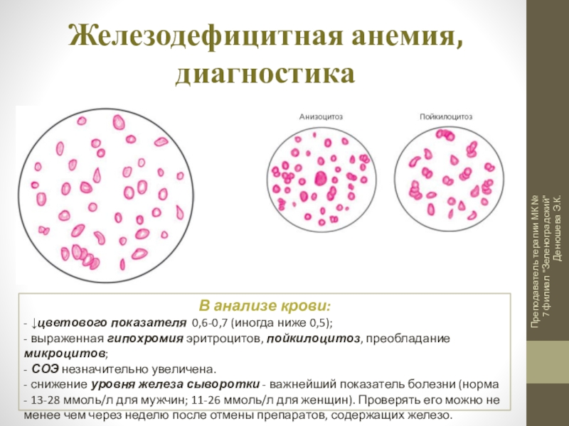 Железодефицитная анемия сестринская карта