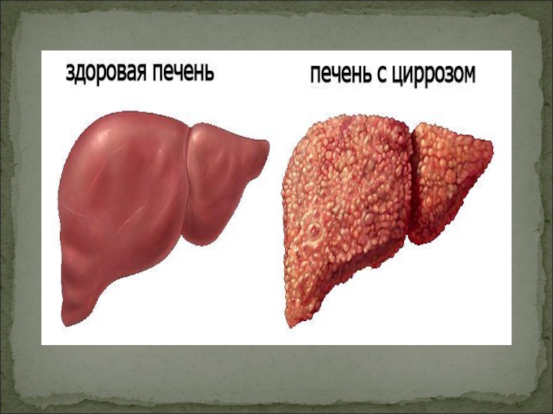 Влияние спиртов на организм человека презентация