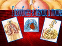 Презентація Газообмін в легеннях та тканинах