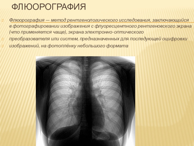 Рентгенологическое исследование при котором получают изображение исследуемого объекта это