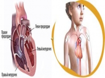 Презентация к уроку л/а метапредметной направленности