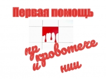 Презентация первая медицинская помощь при кровотечении