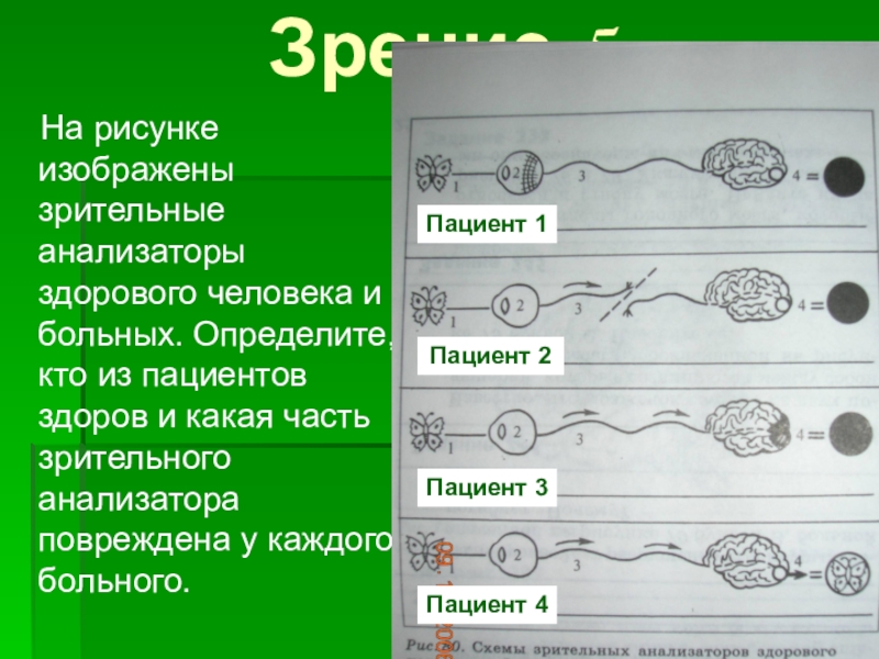 Рассмотрите рисунок 138 укажите у кого из пациентов зрение нормальное и какими нарушениями зрения