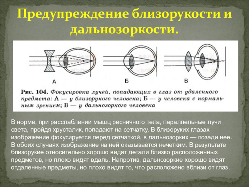 Какая из схем хода лучей в глазу человека