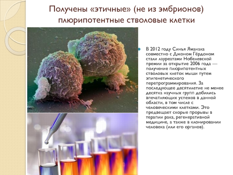 Открытия 21 века. Синъя Яманака стволовые клетки. Этичные плюрипотентные стволовые клетки. Получение стволовых клеток этичным путем. Исследования в области стволовых клеток Синъя Яманака и Джон Гердон.