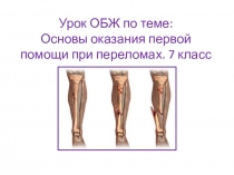 Основы оказания первой помощи при переломах.