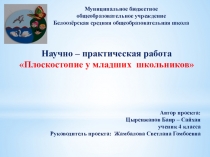 Плоскостопие у младших школьников