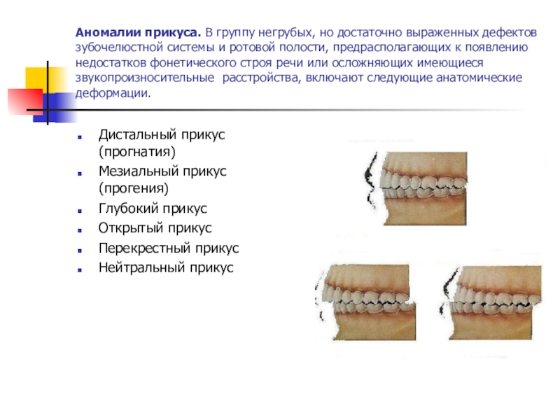 Виды прикусов презентация