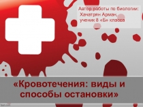 Презентация к уроку биологии Кровотечение