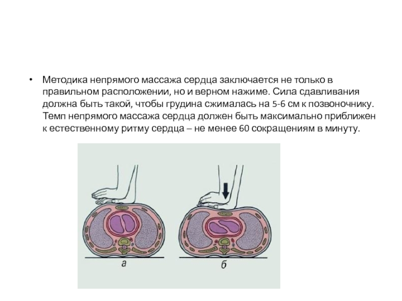 При проведении наружного. Методика наружного массажа сердца. Методика непрямого массажа сердца. Схема проведения наружного массажа сердца. Методика проведения непрямого закрытого массажа сердца.