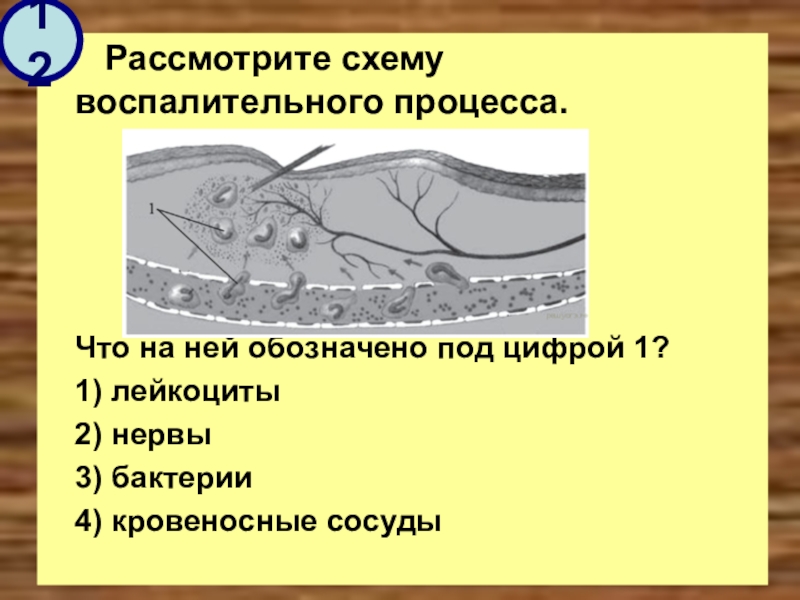 Рассмотрите схему воспалительного процесса