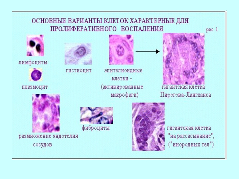 Воспаление патология презентация