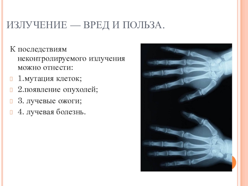 Рентгеновские лучи. Икс лучи. Вред рентгеновских лучей. Польза и вред рентгеновского излучения. Вред и польза рентгеновских лучей.