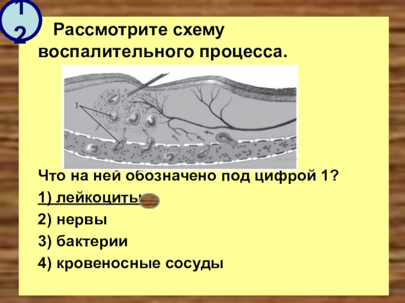 Схема воспалительного процесса с обозначениями