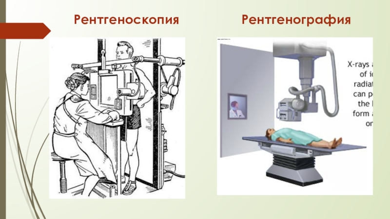 Рентгеноскопия. Рентгеноскопия слайд. Рентгеноскопия презентация. Рентгеноскопия и рентгенография.