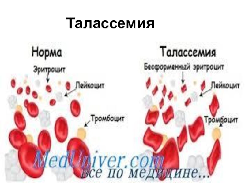 Талассемия клиническая картина