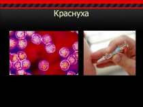 Презентация по Биологии на тему Вирусы. Краснуха