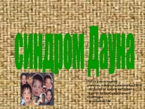 Психолого- педагогическое сопровождение детей с синдромом Дауна