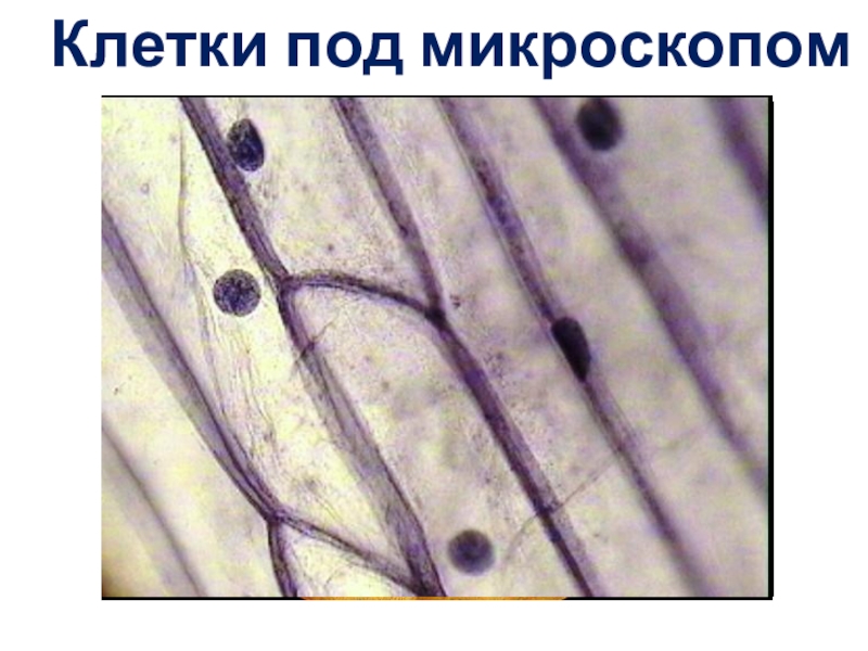 Строение микропрепарата. Микро припорат кожеца Лукк. Микропрепарат чешуи лука. Микропрепарат клетки кожицы лука. Микропрепарат клетки чешуи лука.