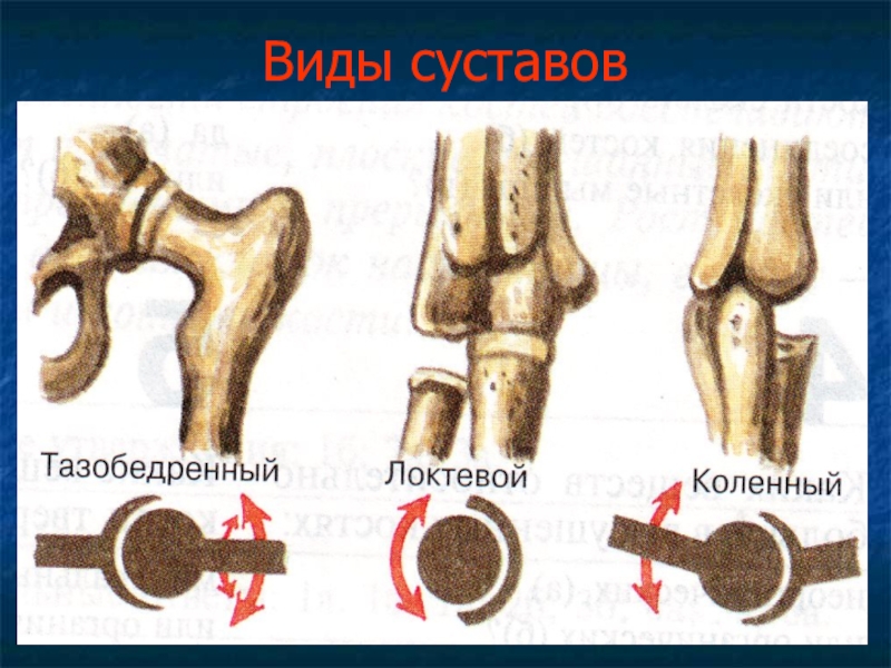Бедренная кость тип соединения костей. Соединения костей блоковидный сустав. Подвижные соединения суставы. Соединение костей суставы. Подвижные соединения костей.
