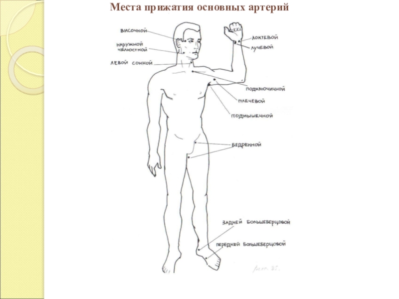 Покажите на рисунке из учебного пособия точки прижатия важнейших артерий сонной