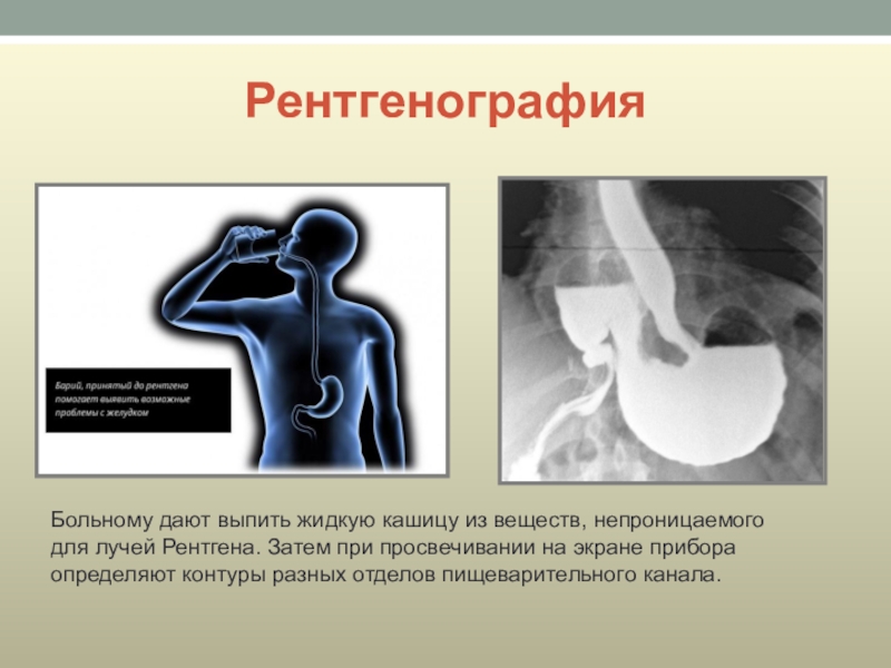 При рентгеноскопии изображение внутренних органов