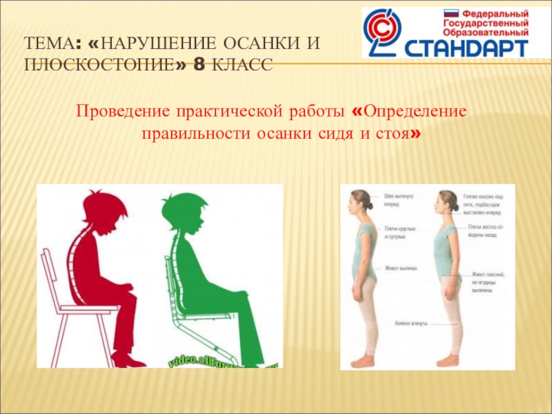 Презентация нарушение осанки