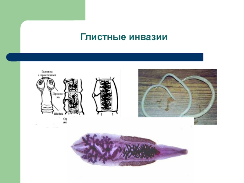 Инвазия это. Инвазии глистные инвазии. Глистные инвазии презентация. К глистным инвазиям заболеваниям относятся. Гельминтозная инвазия.