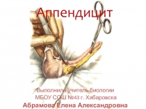 Презентация по биологии на тему аппендицит (8 класс)