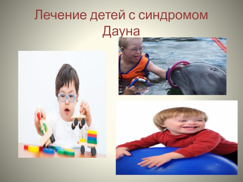 лечение дауна