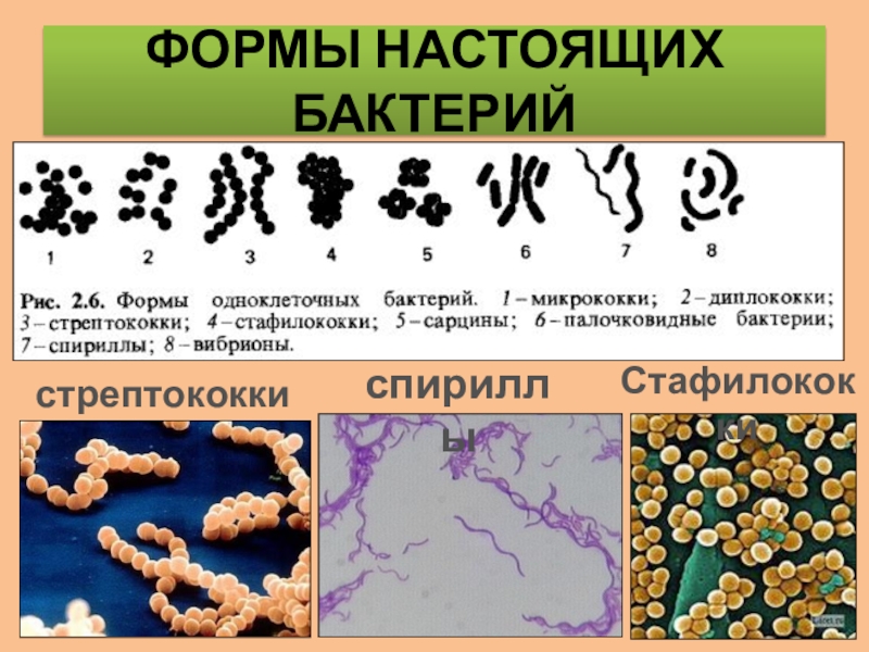 Охарактеризуйте бактерии. Микрококки диплококки стрептококки стафилококки. Формы бактерий биология 10 класс. Подцарство настоящие бактерии. Бактерии формы бактерий.