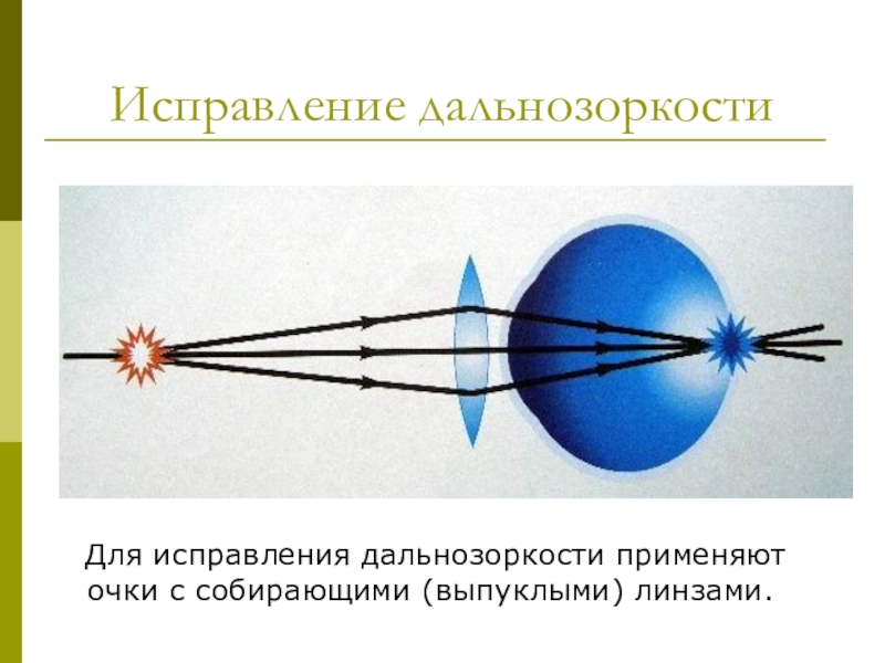 Исправление близорукости физика рисунок