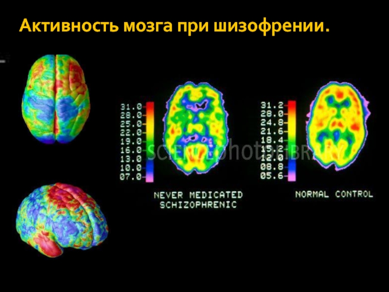 Время активности мозга. Активность мозга. Активность мозга при шизофрении. Электрическая активность мозга. Мозговая активность.