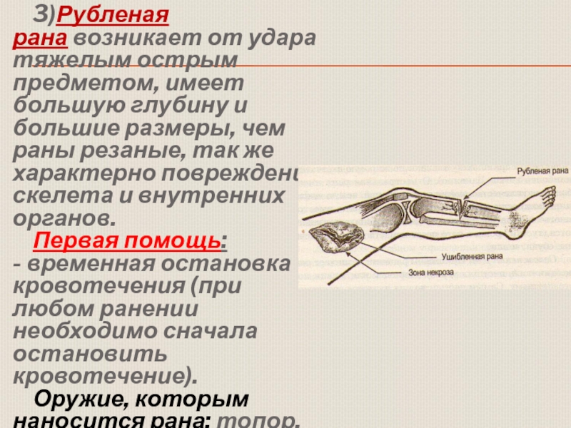 Презентация к уроку обж 11 класс первая помощь при ранениях