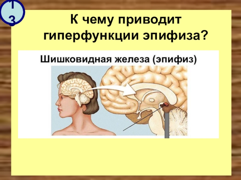 Шишковидная железа находится. Шишковидная железа головного мозга. Пинеальная железа головного мозга что это такое. Мозг шишковидная железа. Что такое шишковидная железа в головном.