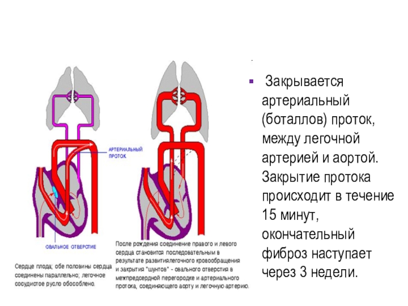 Закрыть в течение. Закрытие артериального протока. Проток между аортой и легочной артерией. Артериальный боталлов проток. Функциональное закрытие артериального протока происходит:.