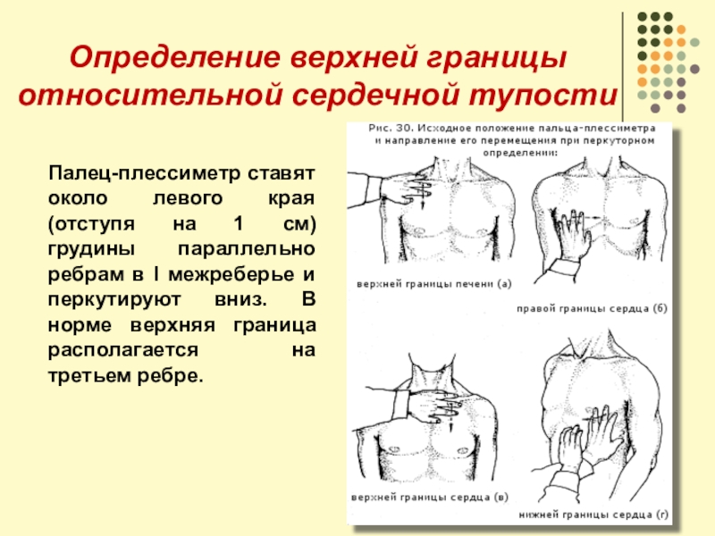 Верхняя граница относительной сердечной