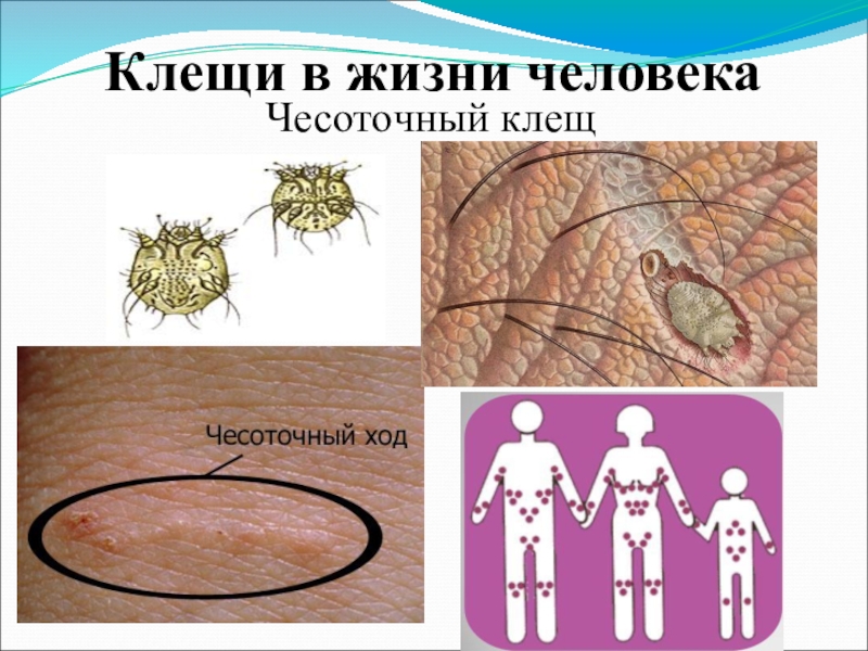 Как избавиться от чесоточного клеща. Чесоточный зудень у человека. Как выглядит чесоточный клещ.