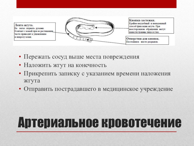 Предупреждение травматизма и оказание первой помощи при травмах и ушибах презентация