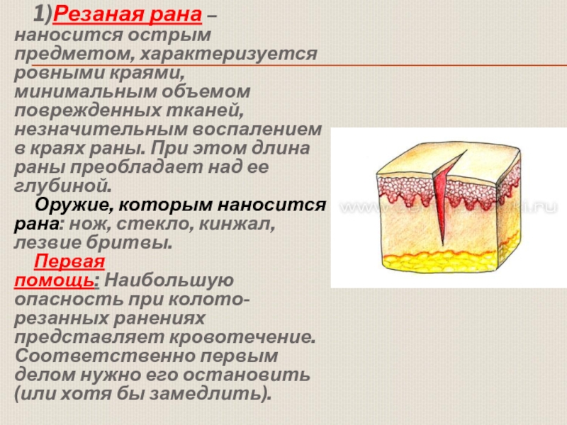 Ткань рана. Резаные раны характеризуются. Резаная рана первая помощь. Резаная рана наносится.