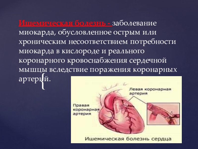 Реферат: Ишемическая болезнь сердца Прогрессирующая стенокардия