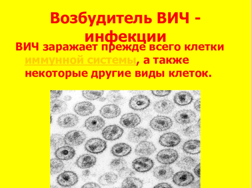 Возбудитель инфекции спид. Возбудитель СПИДА. Возбудитель ВИЧ инфекции. ВИЧ возбудитель. СПИД характеристика возбудителя.