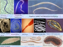 Презентация по биологии Круглые черви 7 класс