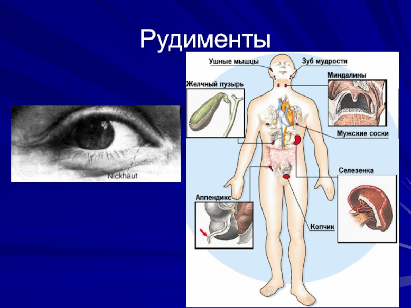 Рудимент это. Рудиментарные органы человека. Рудиментарные органы человека примеры.