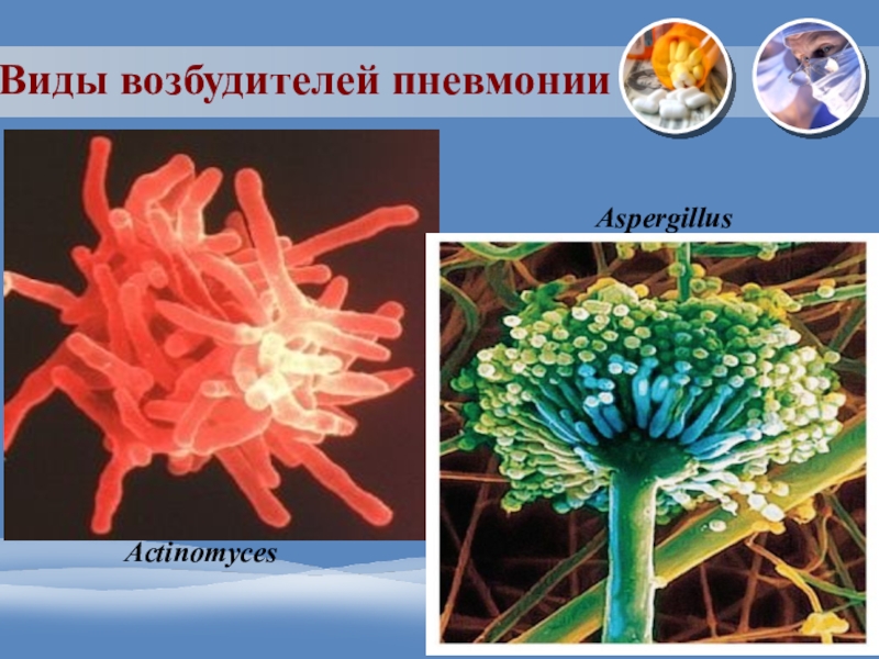 Типы микобактерий. Виды возбудителей. Типы возбудителей. Актиномикоз, аспергиллез. Аспергиллез виды возбудителя.