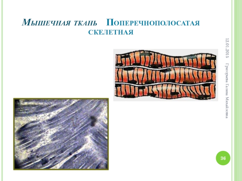 Поперечно полосатая скелетная мускулатура. Поперечно Скелетная мышечная ткань. Поперечная полосатая Скелетная мышечная ткань. Поперечно-полосатая исчерчение мышечной ткани. Исчерченная Скелетная мышечная ткань.