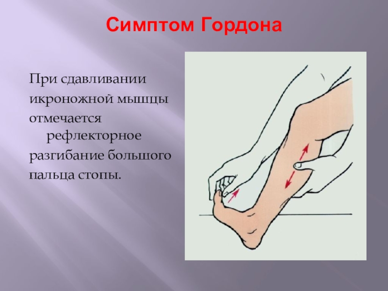 травма икроножной мышцы. икры ног. симптоматика повреждения ахиллова сухожилия. тендинит пхилового сухожилия. надрыв икроножной мышцы.