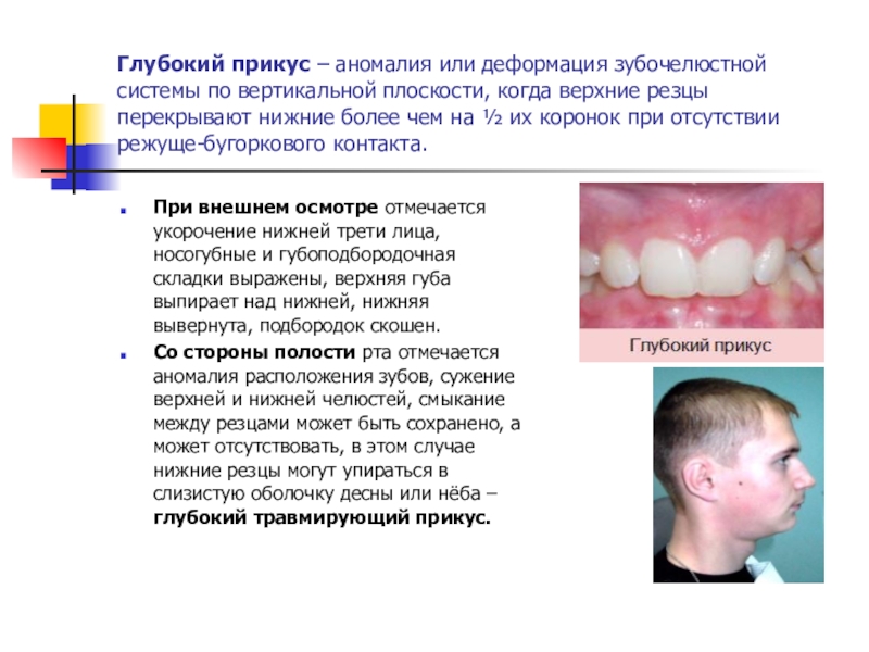 Оперативное лечение при аномалиях и деформациях верхней челюсти презентация