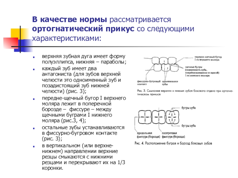 Реферат: Aномалии зубочелюстной системы