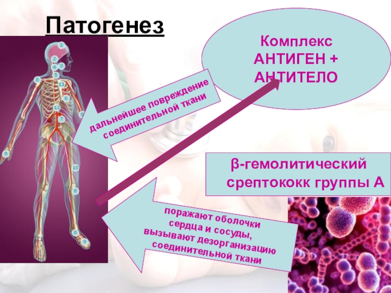 Ревматизм иммунология презентация